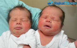 Kovács Jázmin és Dália, 2830 gr. 3030 gr.